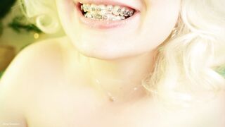 This Giantess Eats in Braces